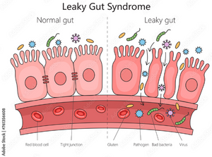 Glyphosate and Gut Health: What It Means for Your Microbiome and How to Build Resilience